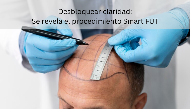 procedimiento smart fut