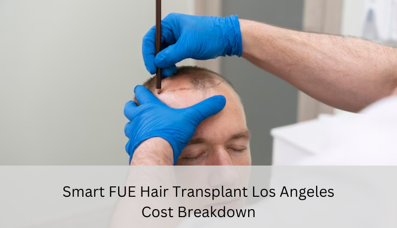 smart FUE hair transplant Los Angeles cost