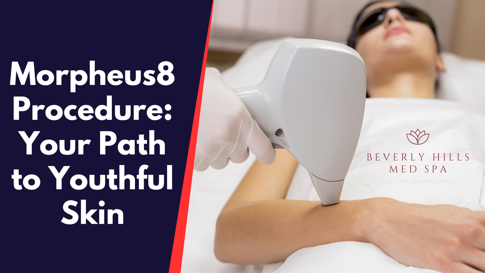 Morpheus8 Procedure: Your Path to Youthful Skin
